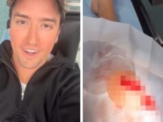 Logan z Big Time Rush trafił do szpitala po rozcięciu kolana na scenie, patrz zdjęcie