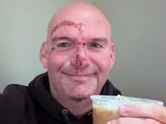 Senator John Fetterman dzieli się zdjęciem z okresu rekonwalescencji po hospitalizacji z powodu serca