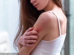 Czy zawsze swędzi Cię i nie masz pojęcia dlaczego? DR PHILIPPA KAYE ujawnia poważny problem narządowy, który może być przyczyną, oraz dodatkowe objawy, które oznaczają, że MUSISZ udać się do lekarza