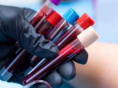 Kongres może zmienić historię raka poprzez głosowanie