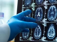 Menopauza „powoduje utratę materii mózgowej, co może wyjaśniać wyższe ryzyko demencji u kobiet” | Wiadomości naukowe, klimatyczne i technologiczne