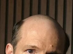 W wieku 24 lat łysiełam i nie mogłam znieść tego wstydu. Potem odkryłam terapię, która działa „w 100% przypadków” i odmieniła moje życie