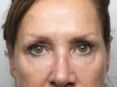 Opiekunka „Czarnej Wdowy” ukradła emerytce 300 tys. funtów, aby sfinansować jej zastrzyki z botoksu | Wielka Brytania | Aktualności