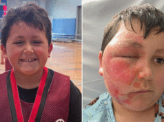 Trend TikToka dotyczący zabawek sensorycznych kończy się tragicznie, ponieważ chłopiec w USA doznaje poważnych oparzeń