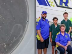 Nastolatek opowiada o bolesnym użądleniu przez meduzę wielkości kciuka, w wyniku którego trafił do szpitala