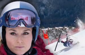 Lindsey Vonn w stabilnym stanie po operacji po wypadku olimpijskim